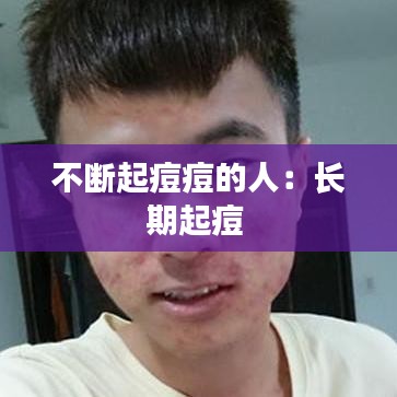 不斷起痘痘的人：長期起痘 