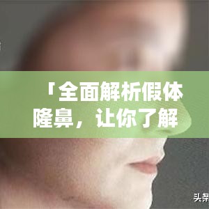 「全面解析假體隆鼻,讓你了解所有細(xì)節(jié)!」