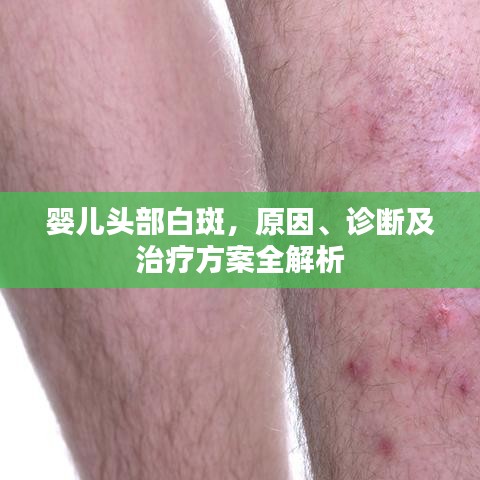 嬰兒頭部白斑，原因、診斷及治療方案全解析