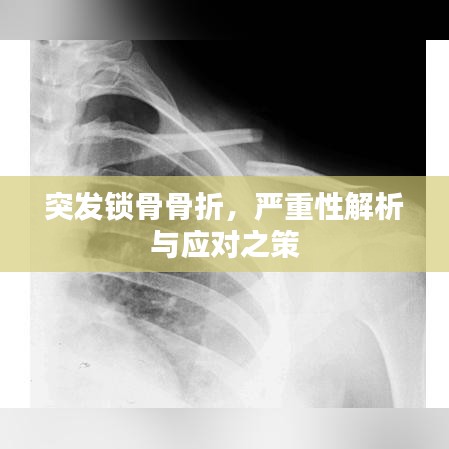 突發(fā)鎖骨骨折，嚴(yán)重性解析與應(yīng)對(duì)之策