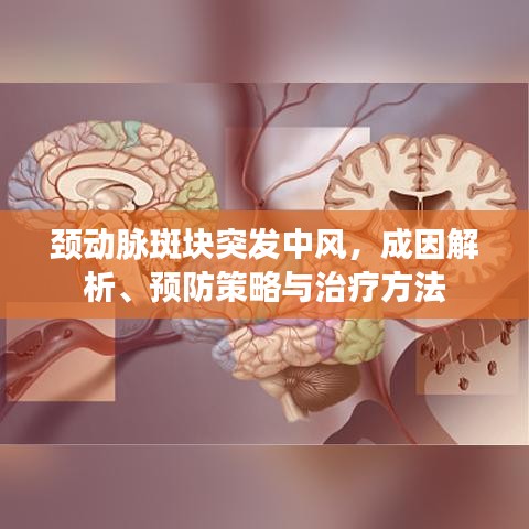 頸動脈斑塊突發(fā)中風(fēng),成因解析、預(yù)防策略與治療方法